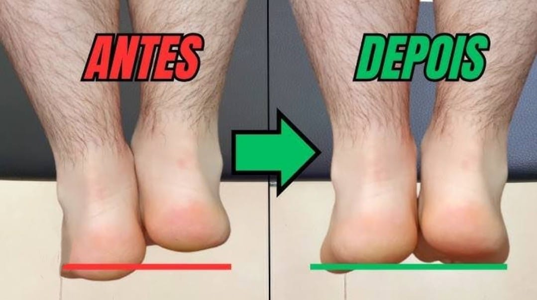 leg check - o que é e o que fazer